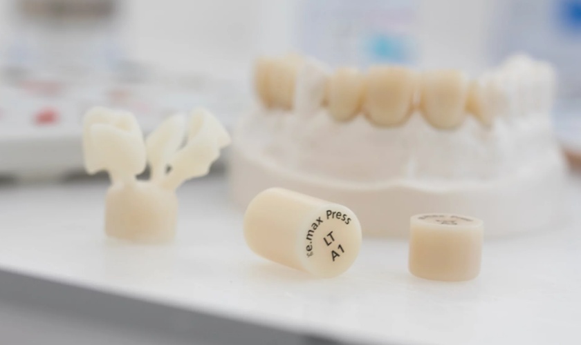 Răng sứ E max có chi phí tương xứng với hiệu quả mang lại